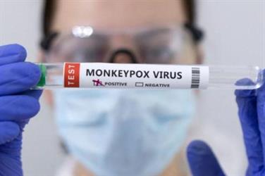 سجّل 50 طفرة جينية.. دراسة ترصد تسارعاً كبيراً في تحوّر فيروس "جدري القرود"
