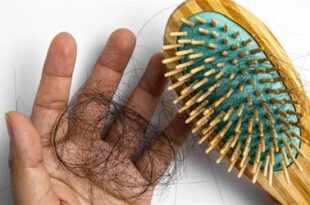 ما علاج نقص مخزون الحديد وتساقط الشعر؟