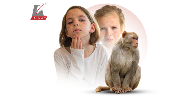 هل يمكن إصابة الأطفال بفيروس جدري القرود ؟