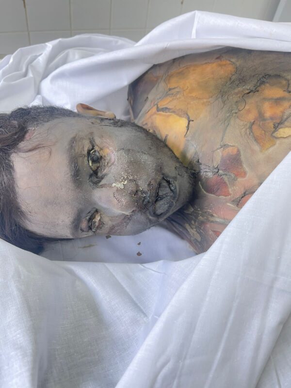 Torture and killing of Ali Atef al Ali